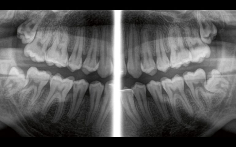 8692021-07-04-204415