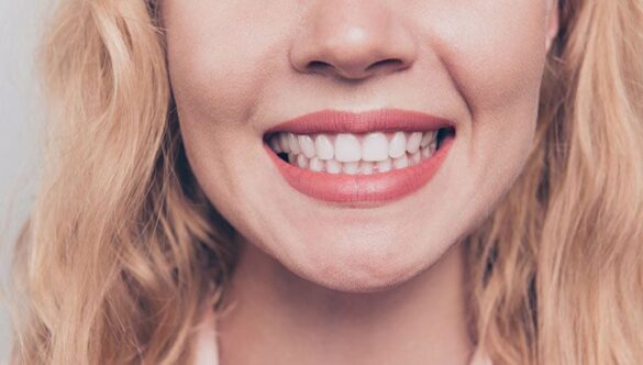 Diş Sıkma Sorunu Neden Oluşur? Tedavi Yöntemleri Nelerdir? Nişantaşı’nda Diş Sıkma Tedavisi Yapan Yer Var mı?